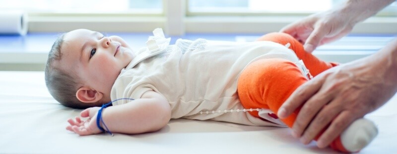 Bebeklerde Kalça Çıkıklığı Nedenleri